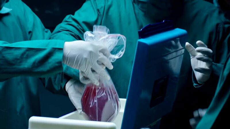 Проблемы трансплантологии: вызовы и перспективы