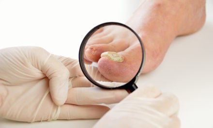 Эффективное средство против грибковой инфекции кожи и ногтей: Обзор Дерматизон геля