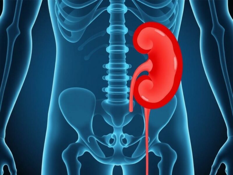  Appendicitis vs. Kidney Stones. When to See a Doctor: Urgent Signs