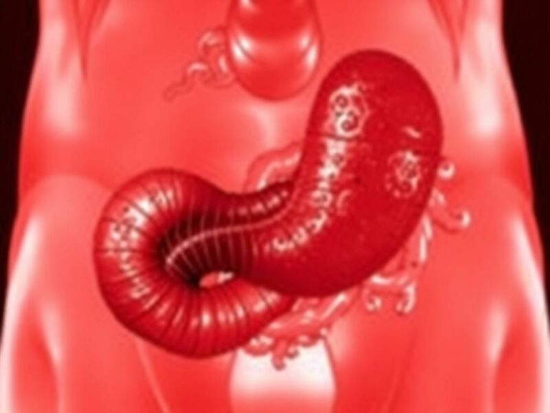  Appendicitis and Parasitic Infections. Diagnosing Appendicitis Due to Parasitic Infections