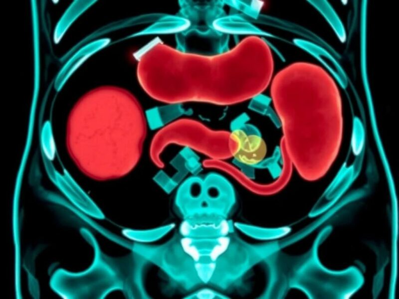  How Is Appendicitis Diagnosed?. Imaging Techniques: Seeing Inside the Abdomen