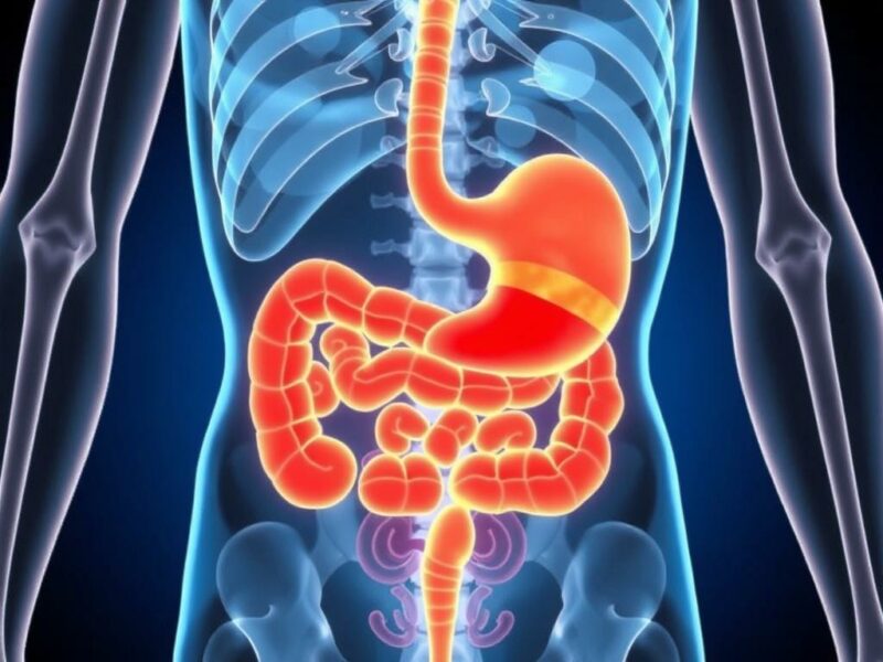  Appendicite et Nausées : Pourquoi ces Symptômes ?. Qu’est-ce que l’appendicite ? Définition et causes