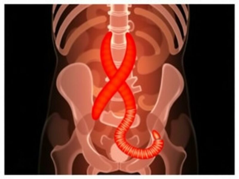  Appendicitis in HIV Patients. Potential Complications of Appendicitis in HIV Patients