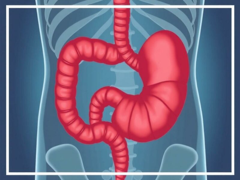  Appendicite et Nausées : Pourquoi ces Symptômes ?. Conclusion