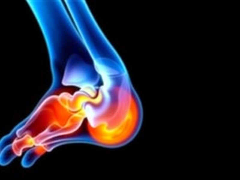 Le plastron appendiculaire : définition et prise en charge.. Opciones terapéuticas: del manejo conservador a la intervención Le plastron appendiculaire : définition et prise en charge.. Opciones terapéuticas: del manejo conservador a la intervención