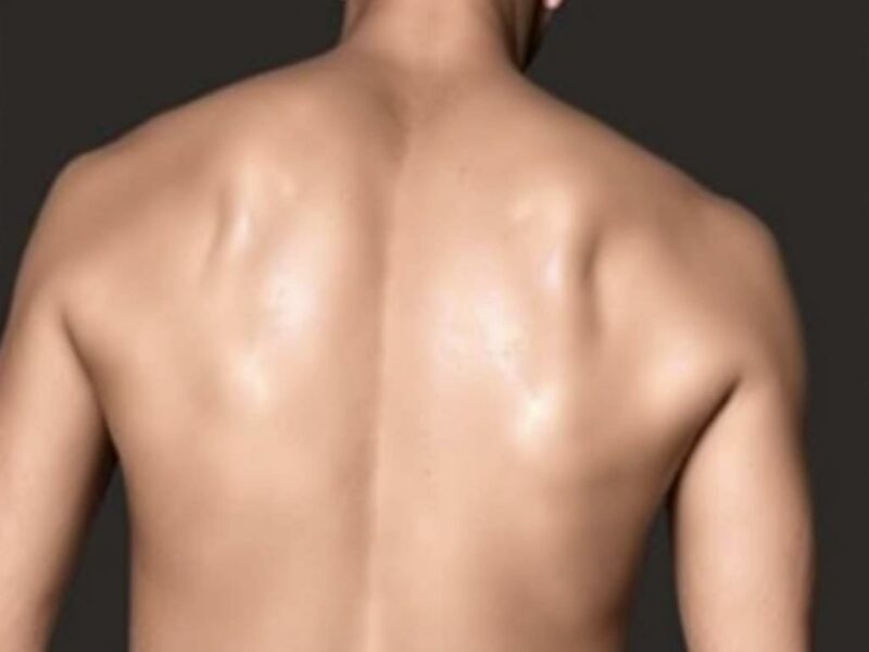 Das Loslass-Schmerzzeichen (Blumberg-Zeichen). Implicaciones para el paciente: cuándo buscar ayuda Das Loslass-Schmerzzeichen (Blumberg-Zeichen). Implicaciones para el paciente: cuándo buscar ayuda