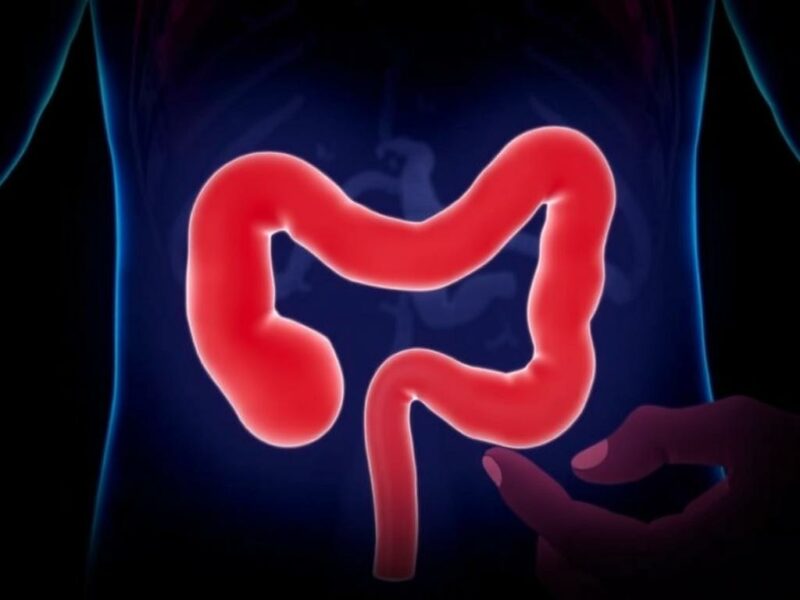 Apendicectomía intervalar (cirugía programada después de tratamiento con antibióticos).. Checklist práctica para pacientes que enfrentan la decisión