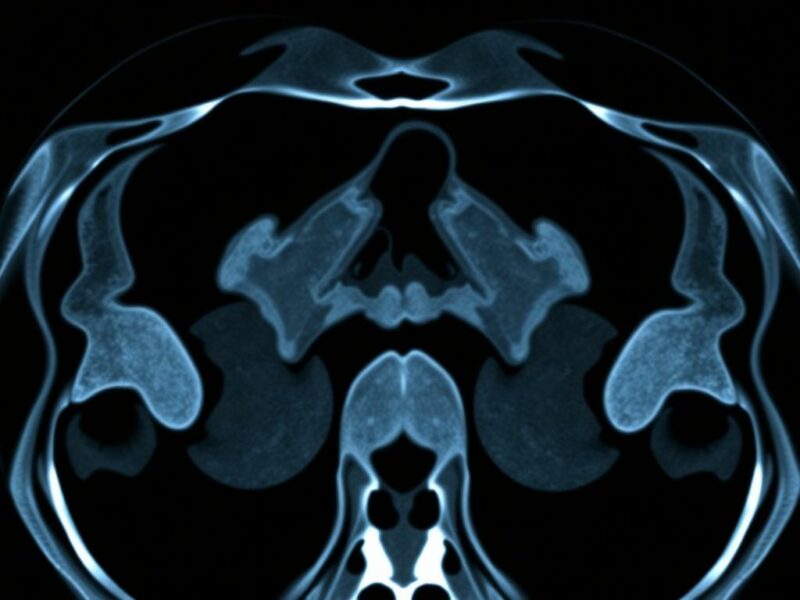L'intelligence artificielle dans le diagnostic scanographique de l'appendicite.. Aspectos regulatorios, de privacidad y éticos