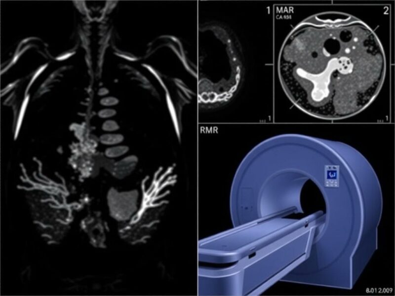 The Diagnostic Dilemma: Avoiding Radiation with Ultrasound and MRI.. Casos clínicos y ejemplos cotidianos