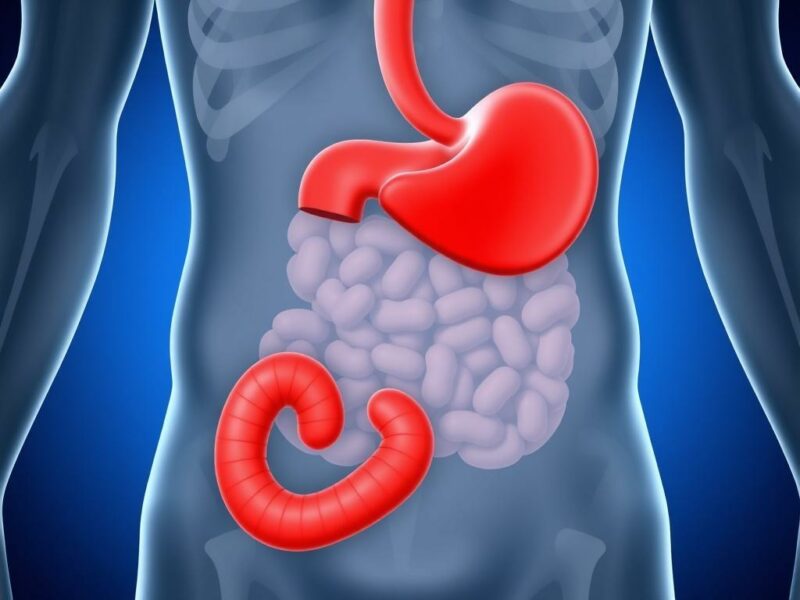 Peritonitis: inflamación generalizada del abdomen.. Casos clínicos breves para entender mejor