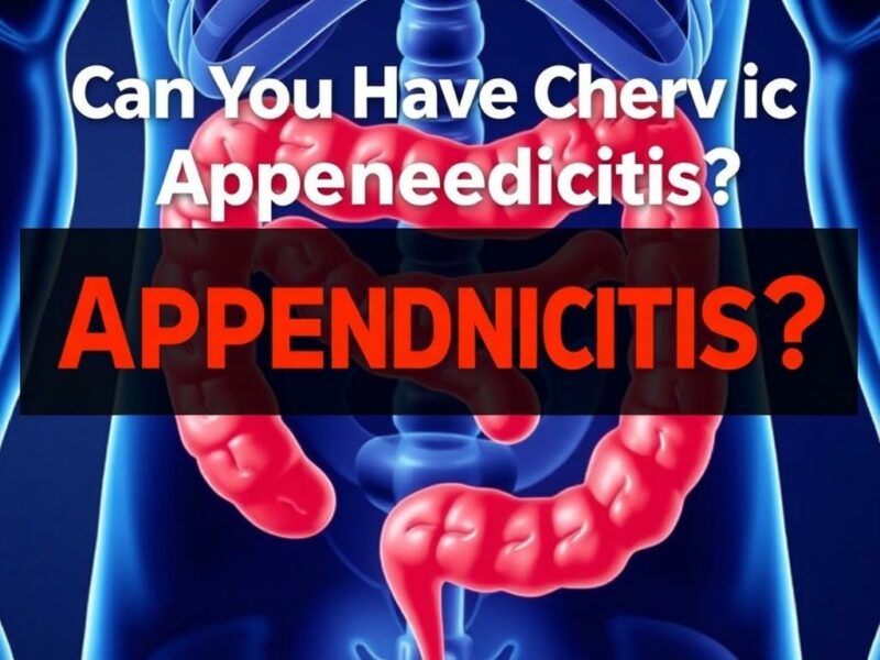 Can You Have Chronic Appendicitis? Debating the Concept.. Conclusión Can You Have Chronic Appendicitis? Debating the Concept.. Conclusión