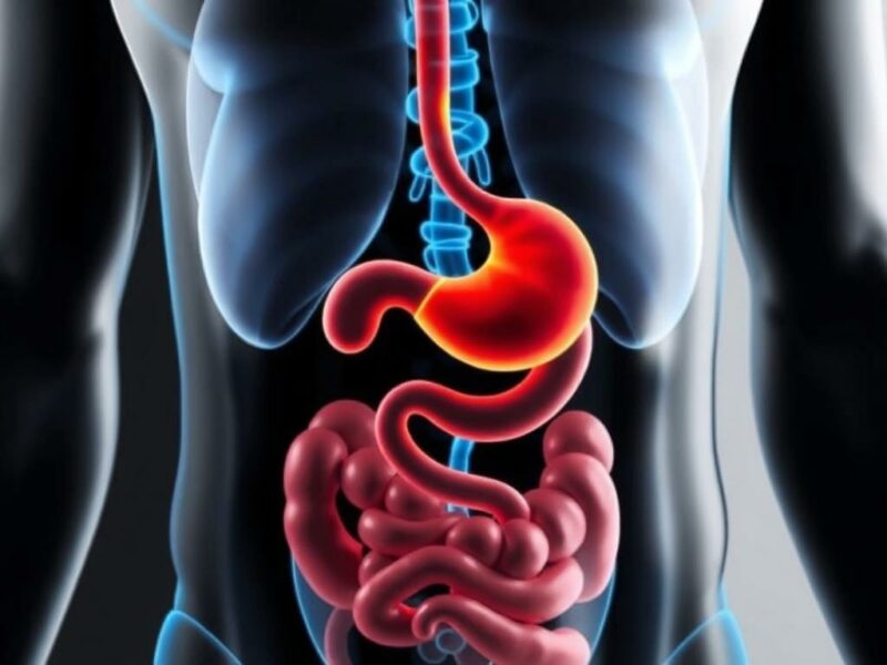 La dieta y su posible influencia en la apendicitis.. Conclusión