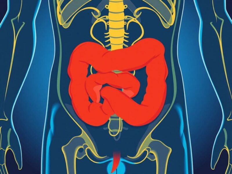 Health Literacy and Understanding Appendicitis.. Cómo desarrollar tu propia alfabetización en salud: pasos prácticos Health Literacy and Understanding Appendicitis.. Cómo desarrollar tu propia alfabetización en salud: pasos prácticos